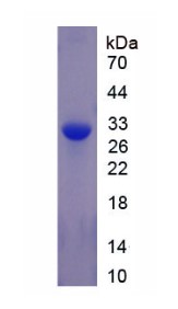 SDS-PAGE TOP2B-466H.jpg